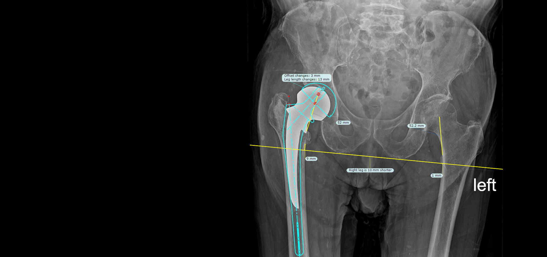 header-full-screen-hip-revision-clean-copy-1-journal.webp