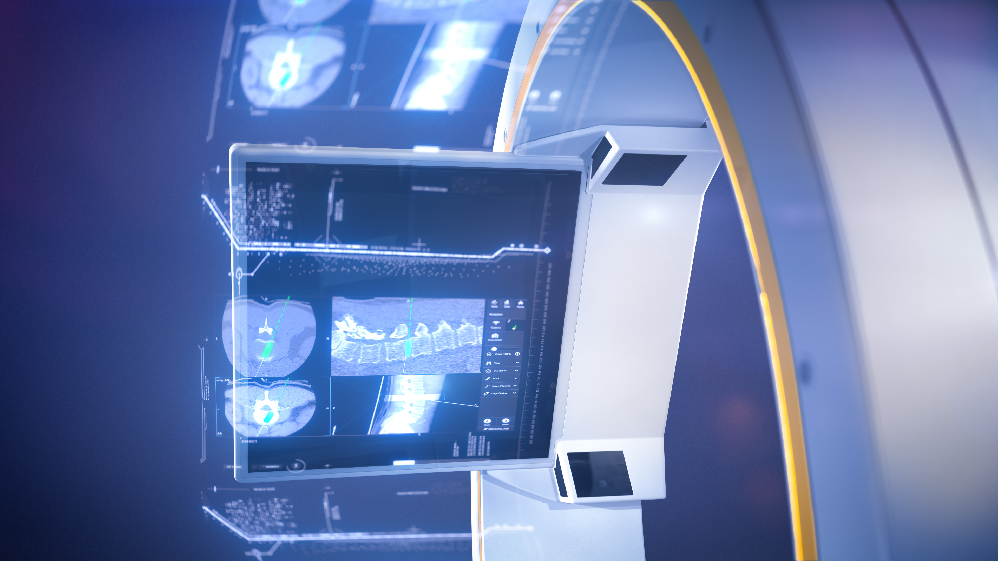 NEW外科学 = NEW Surgery Asensus Surgical unveils next-gen Luna surgical robot platform