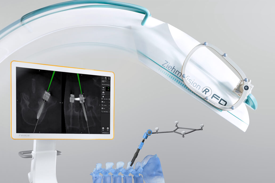 Spinal Navigation: Digitalizing Spine Surgery | Brainlab